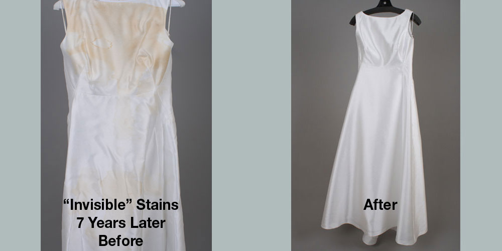 Whole dress stains